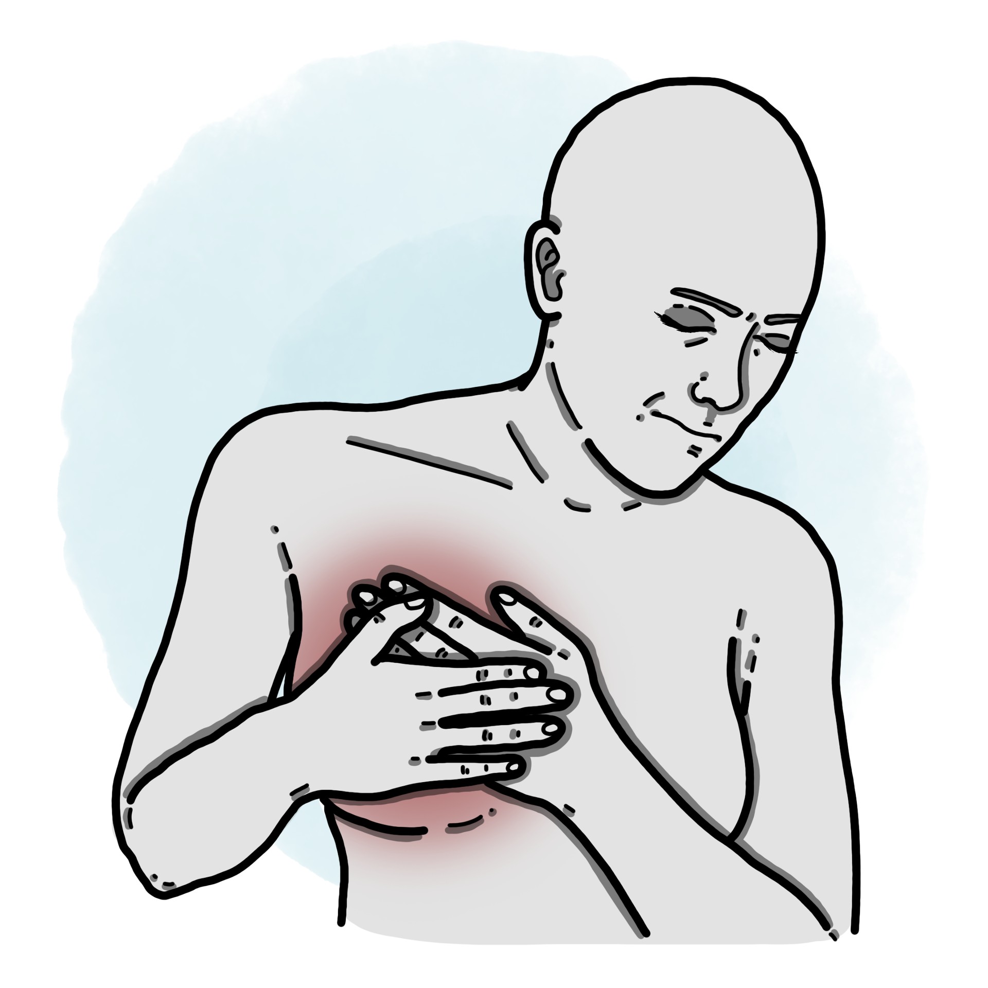 Non-cyclic mastalgia - Mastalgia