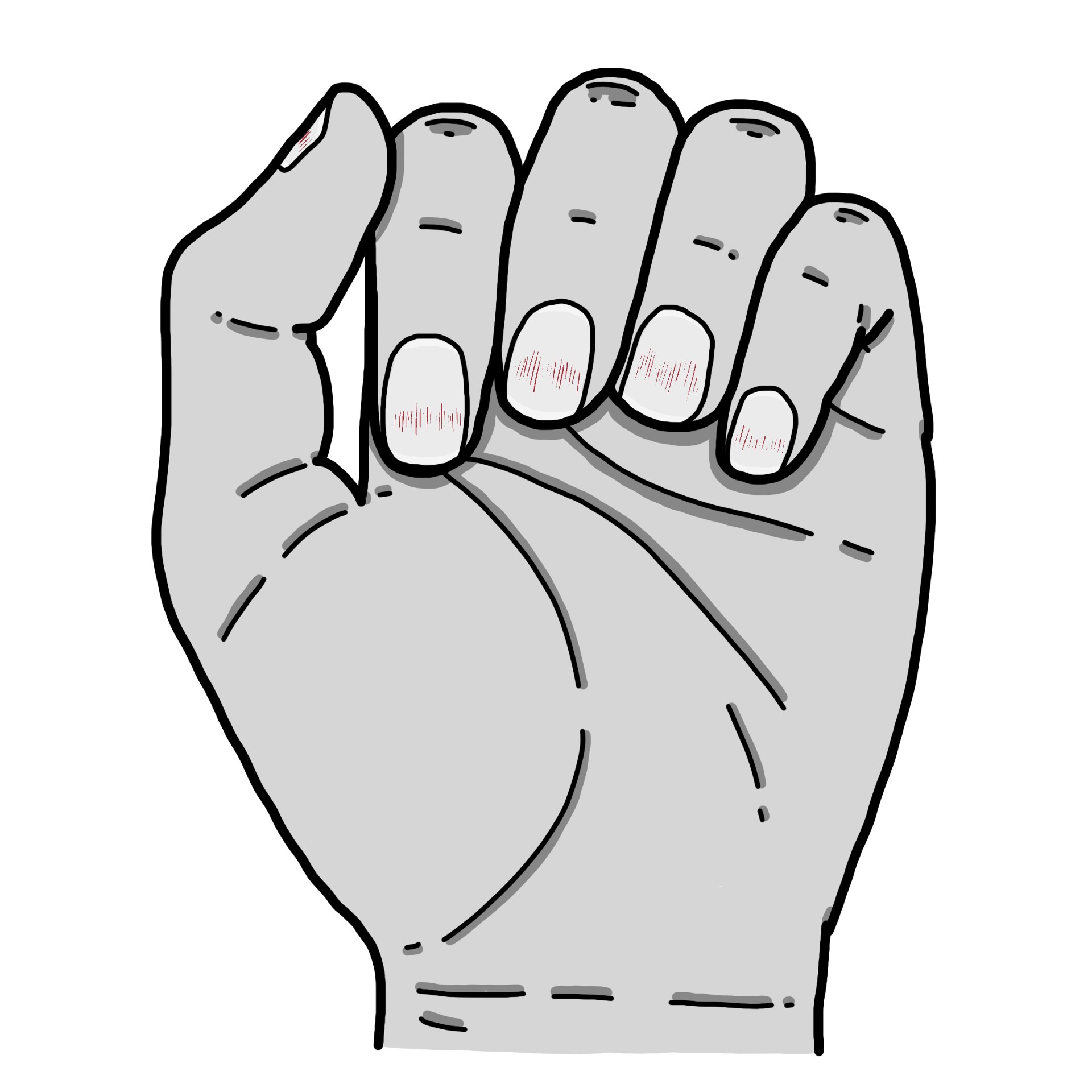 Hemorragias en astilla debajo de las uñas