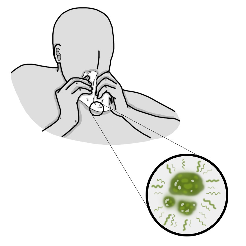 Mucus nasal malodorant