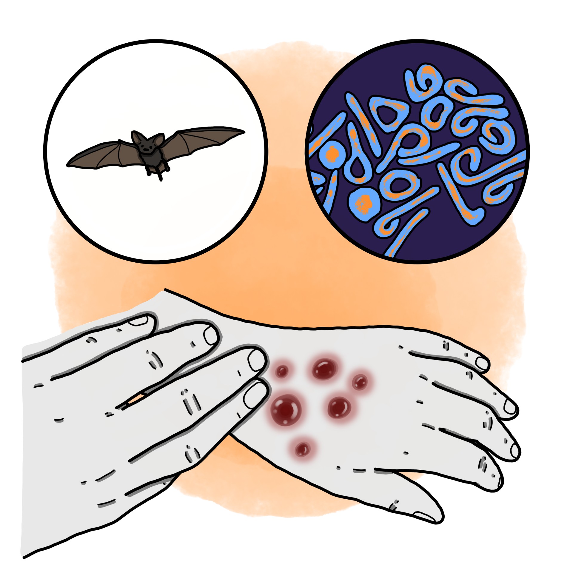 Marburg virus disease