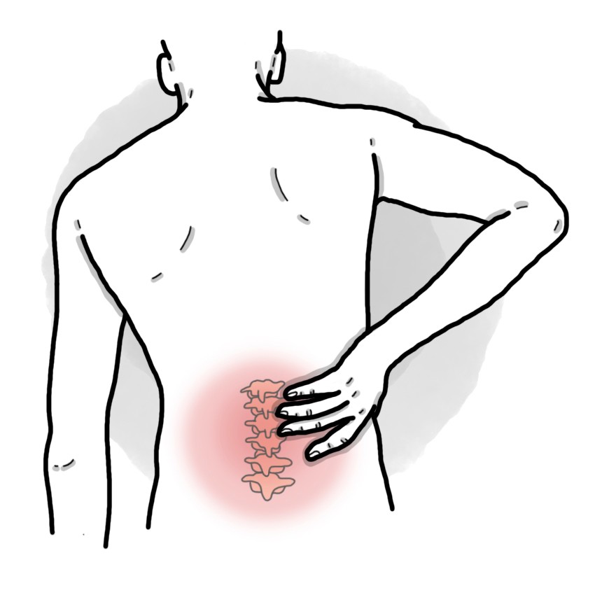 Inflammatory lower back pain