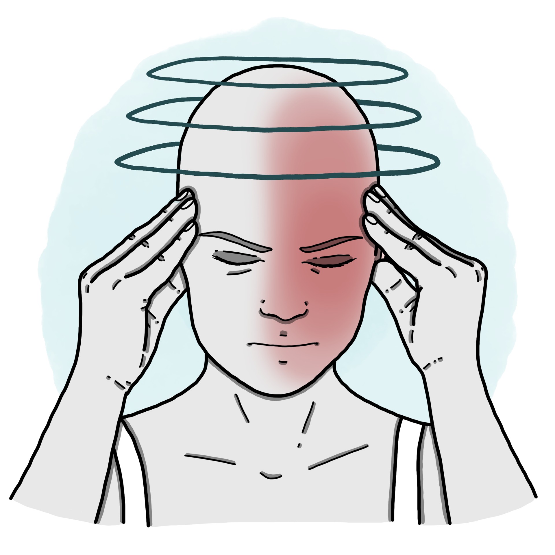 Central vertigo associated with migraine