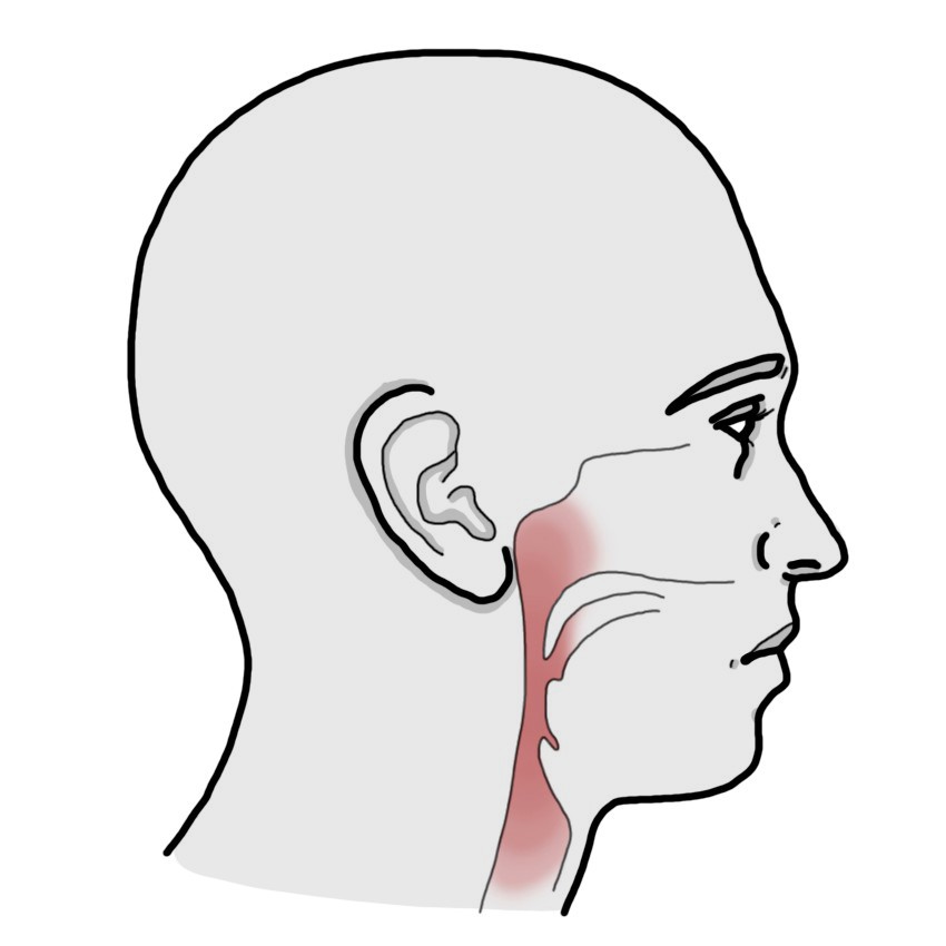Faringitis