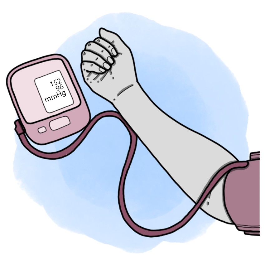 High blood pressure - Arterial hypertension