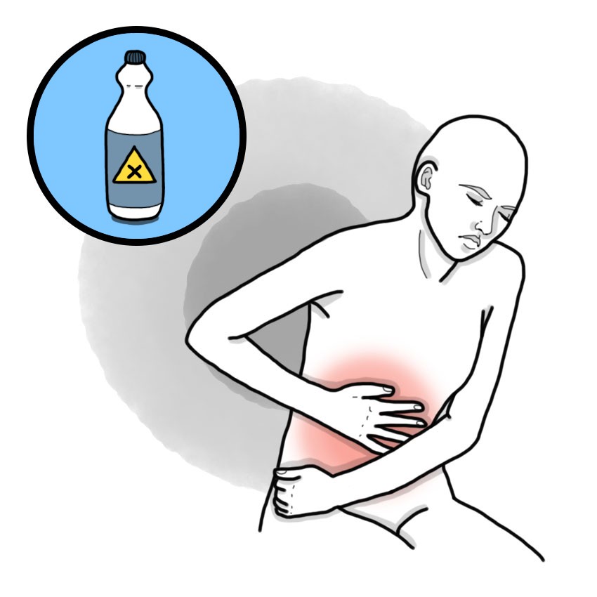 Irritant gas poisoning - Chlorine, formol, ammonia, hydrogen sulphide, etc.