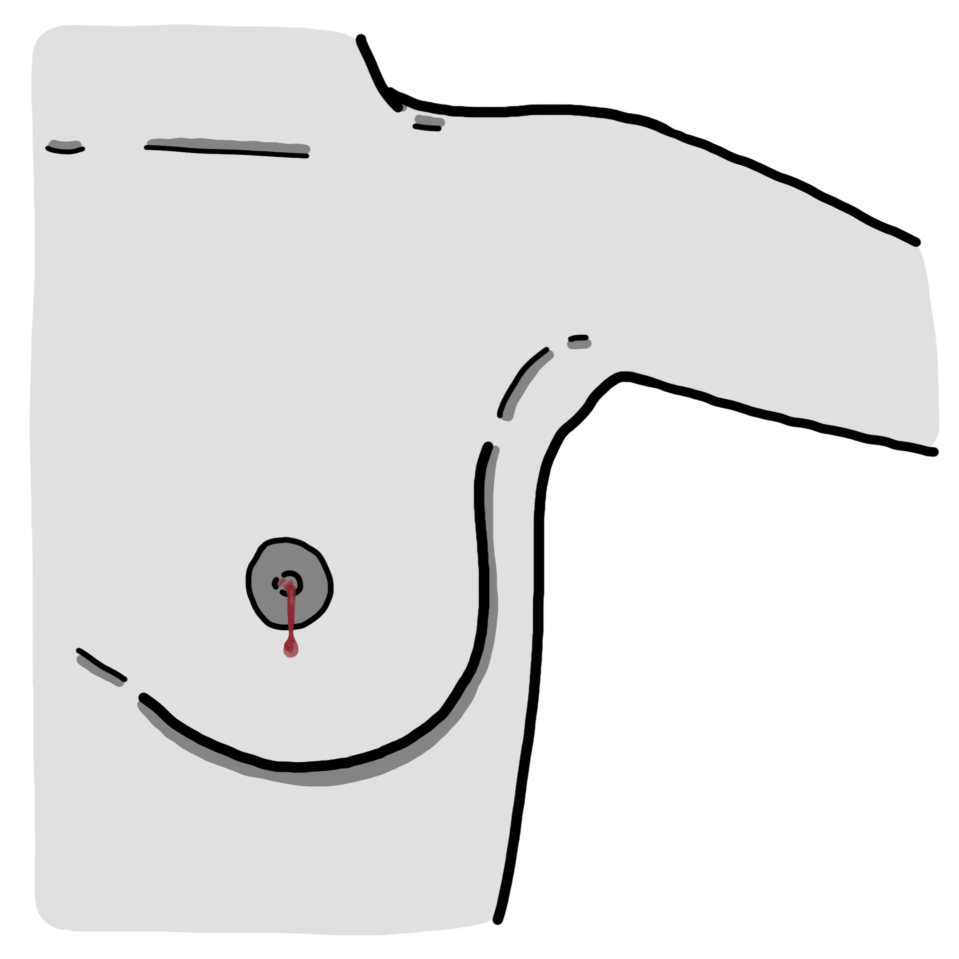 Bleeding from the nipple