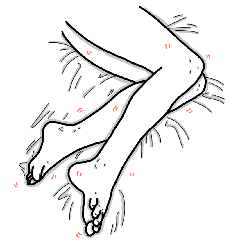 Restless legs syndrome