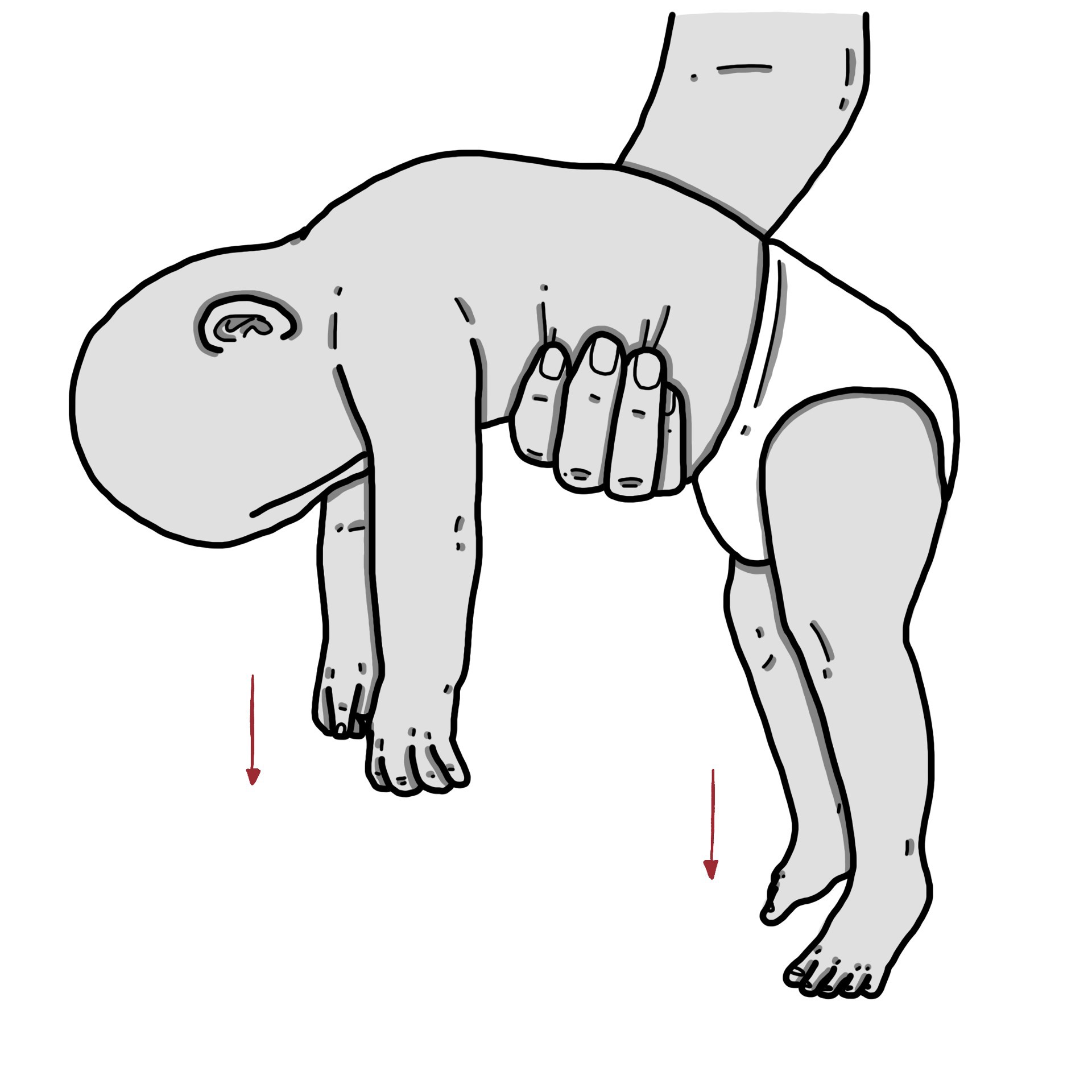Perda de tônus muscular e força
