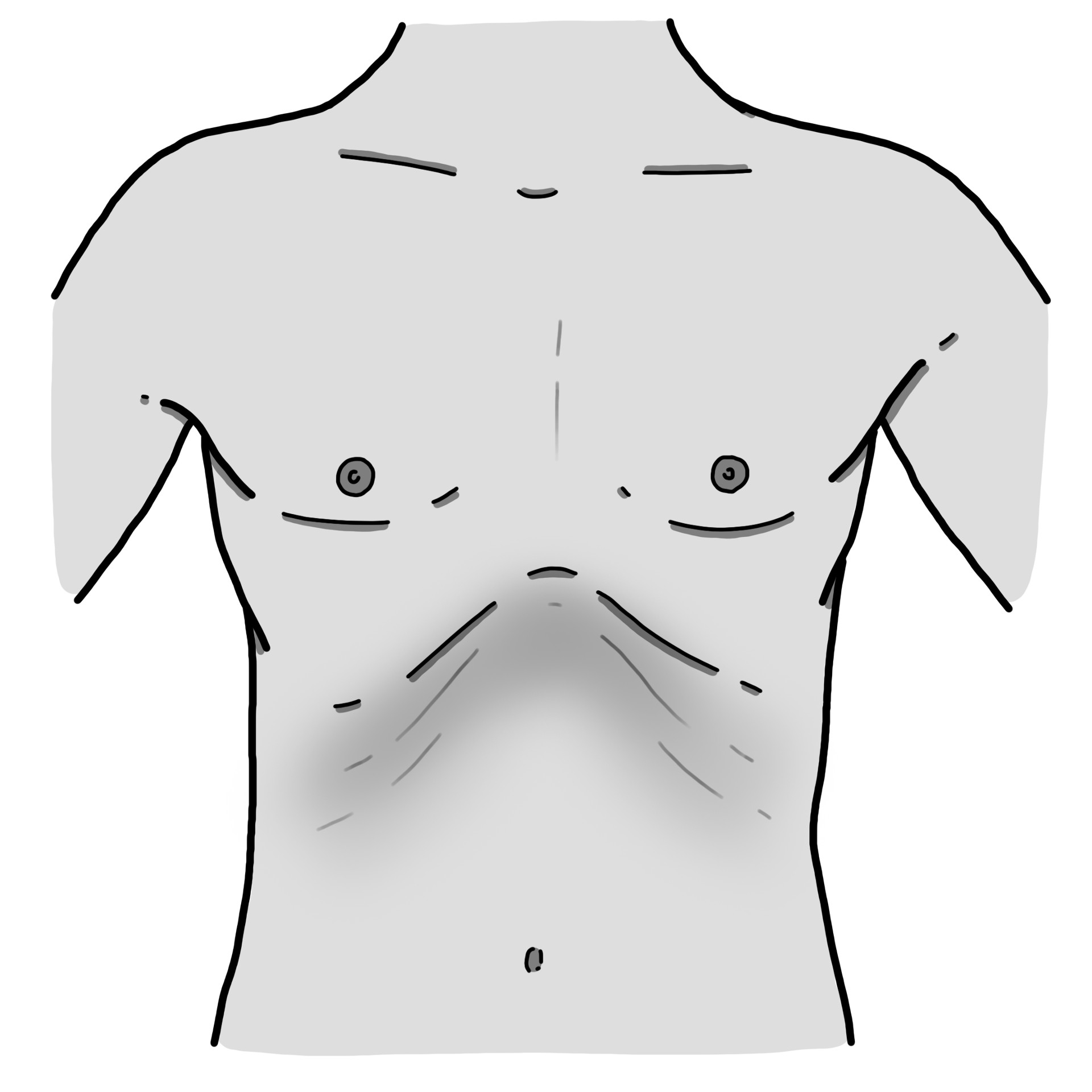 Intercostal retraction when breathing