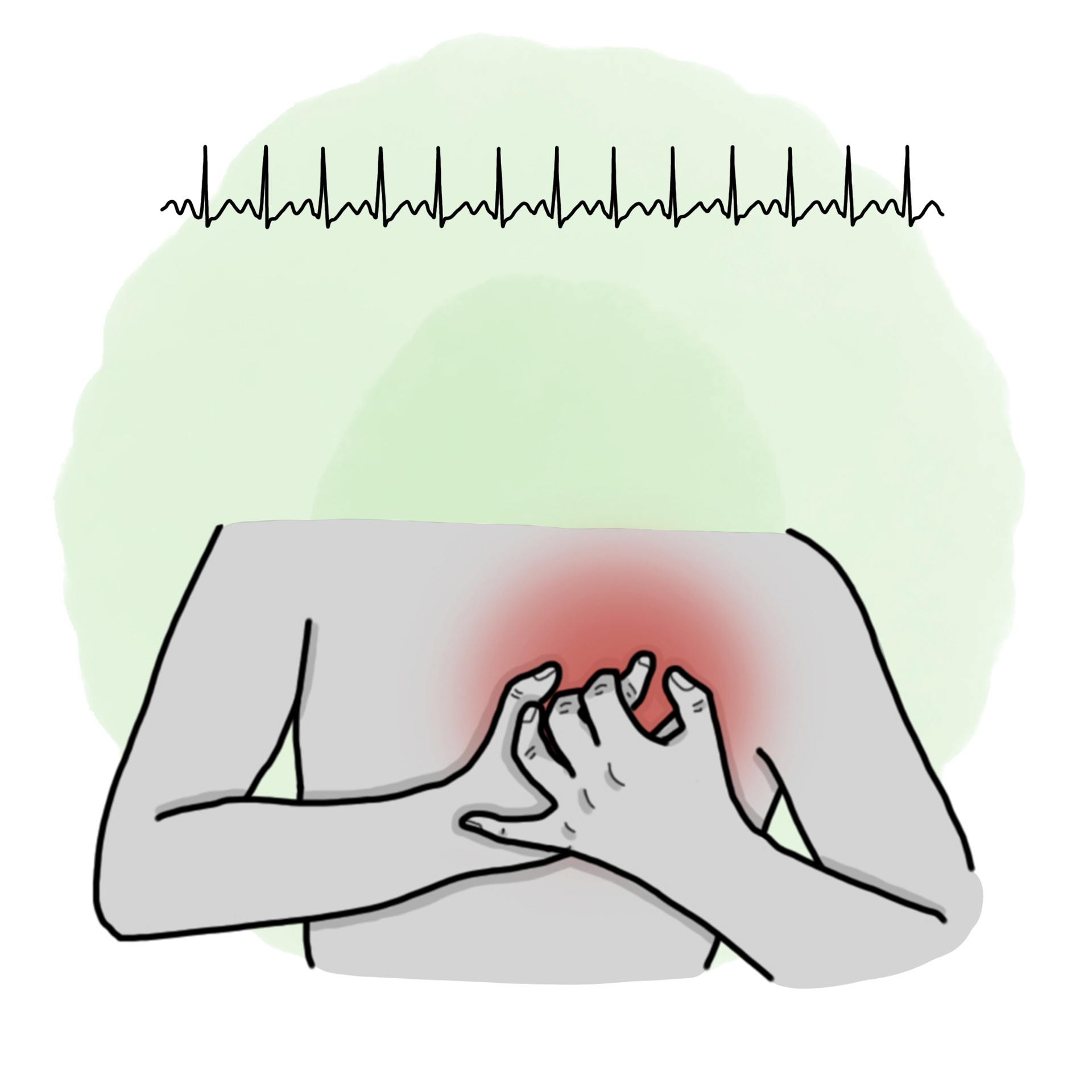 Sinus tachycardia (Paediatrics)