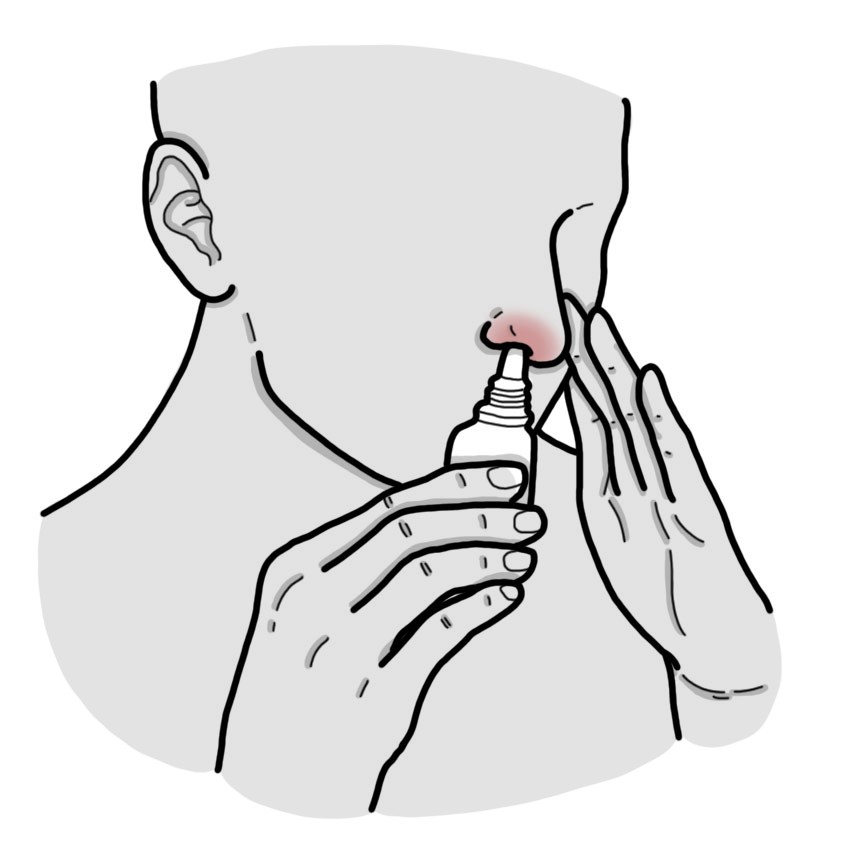 Sécheresse de la muqueuse nasale