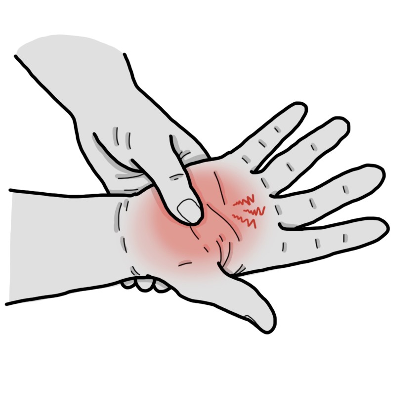 Cramps on the palm of the hand
