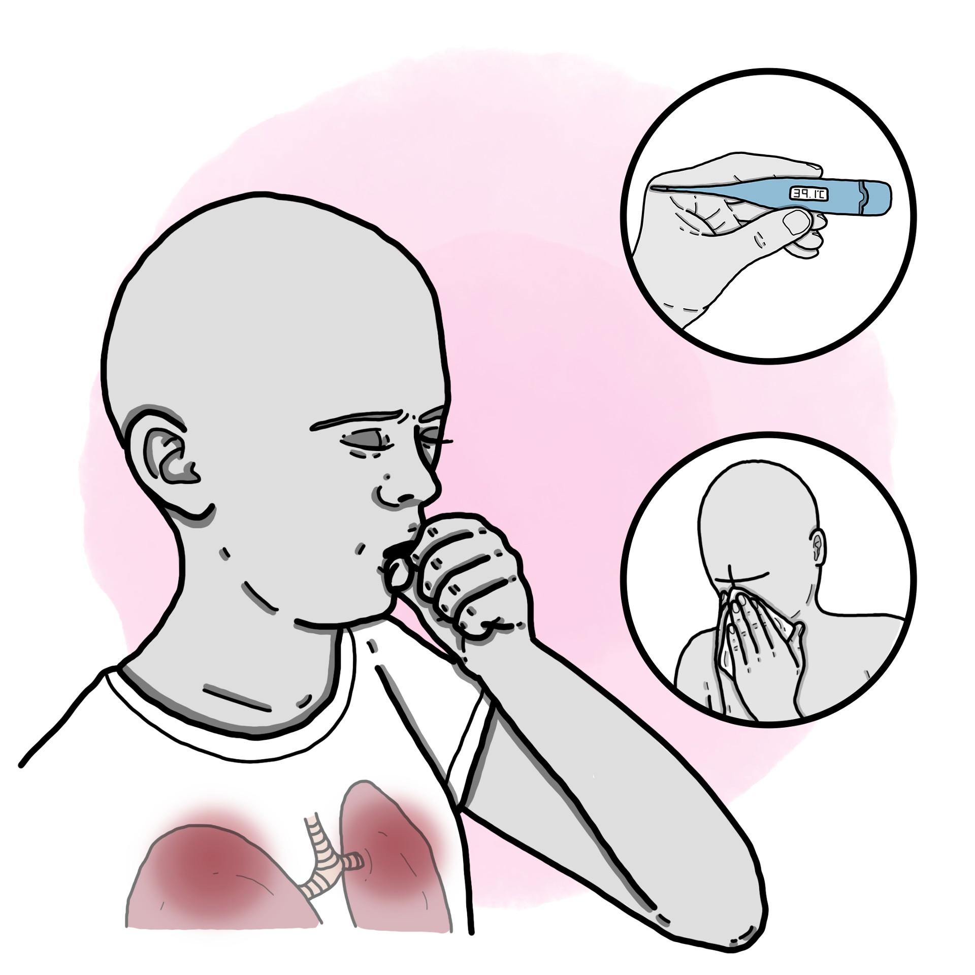 Typical pneumonia - Community-acquired pneumonia (Paediatrics)