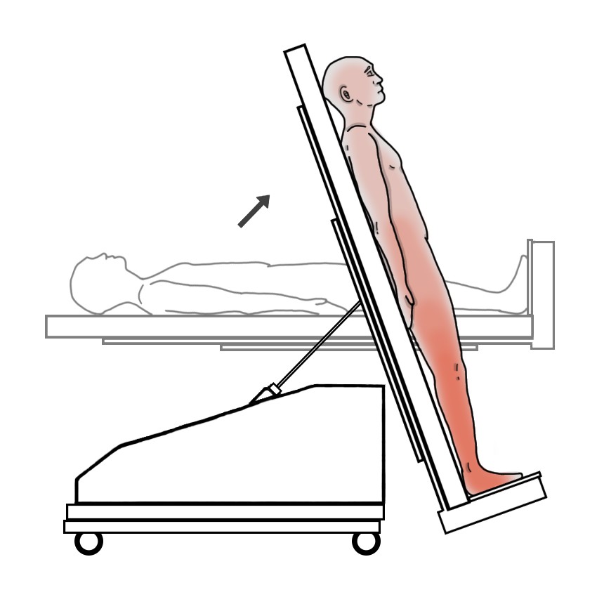 Postural hypotension - Orthostatic hypotension