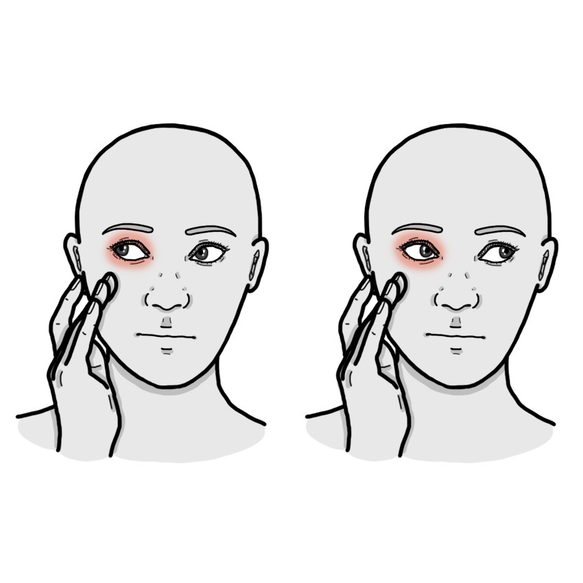 Göz hareketi ile ağrı