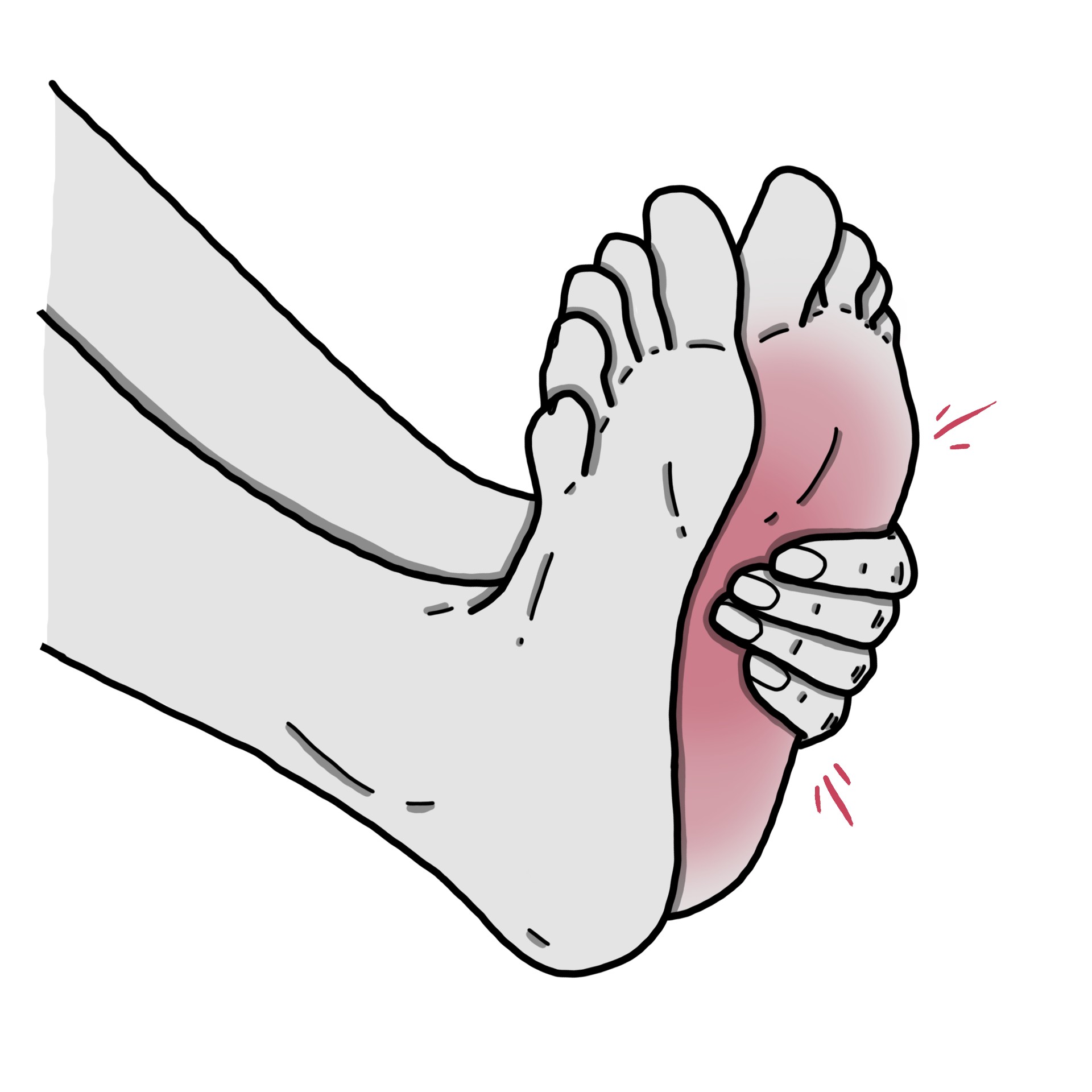 足の裏の赤くてかゆみを伴う皮膚