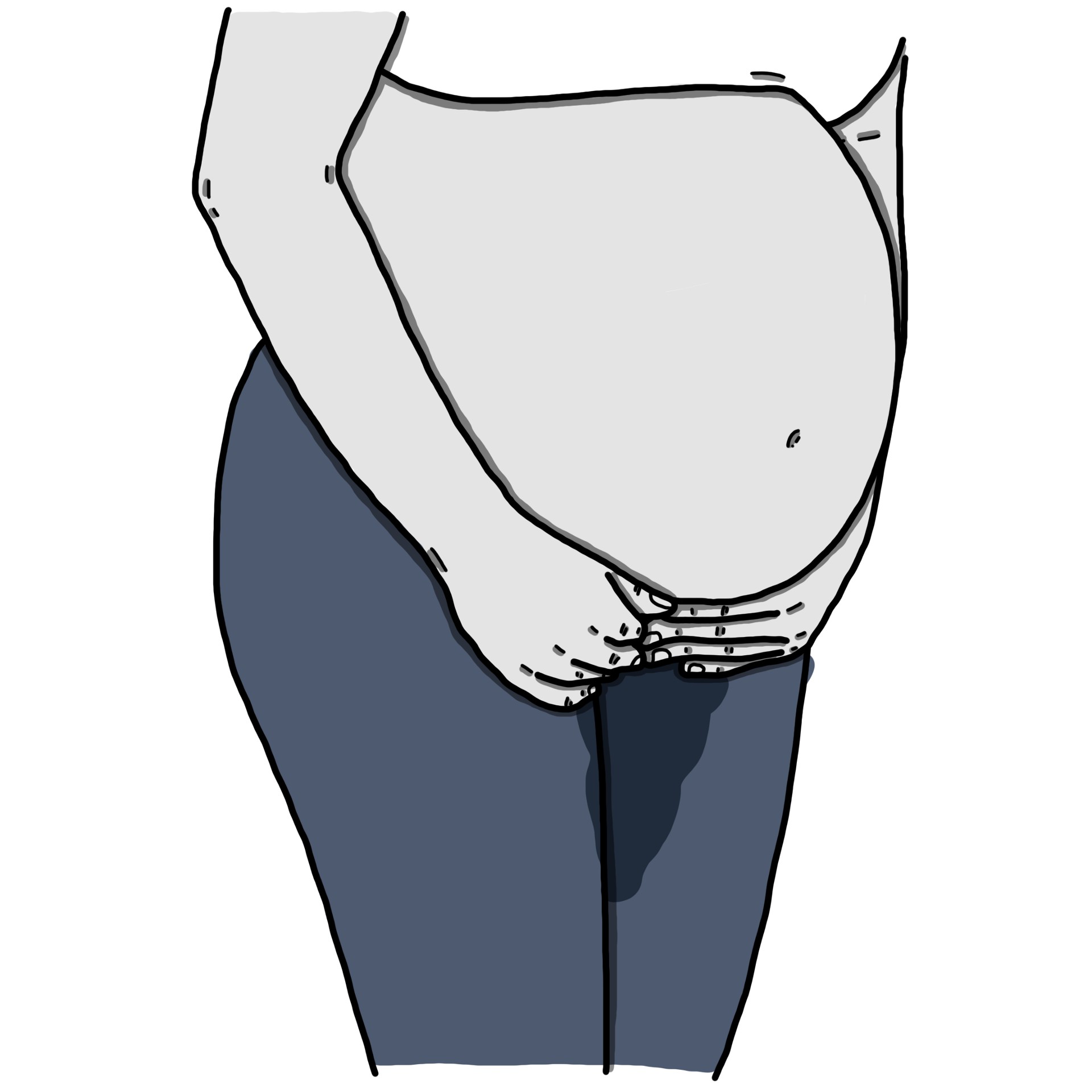 Preterm premature rupture of membranes