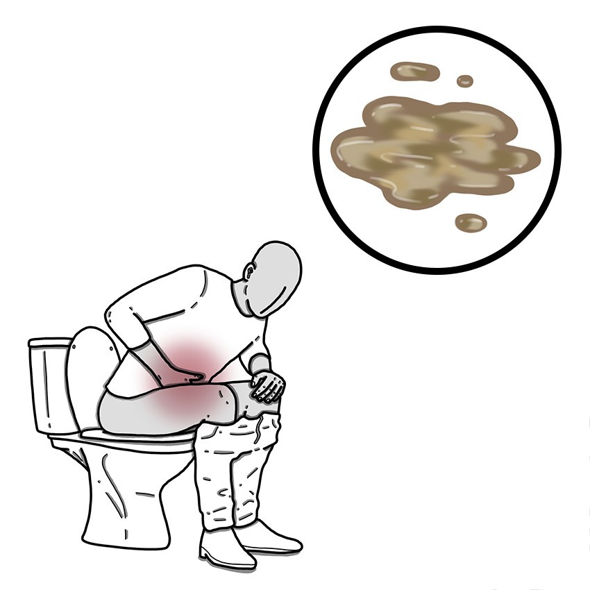 Bouts of abdominal pain and diarrhoea