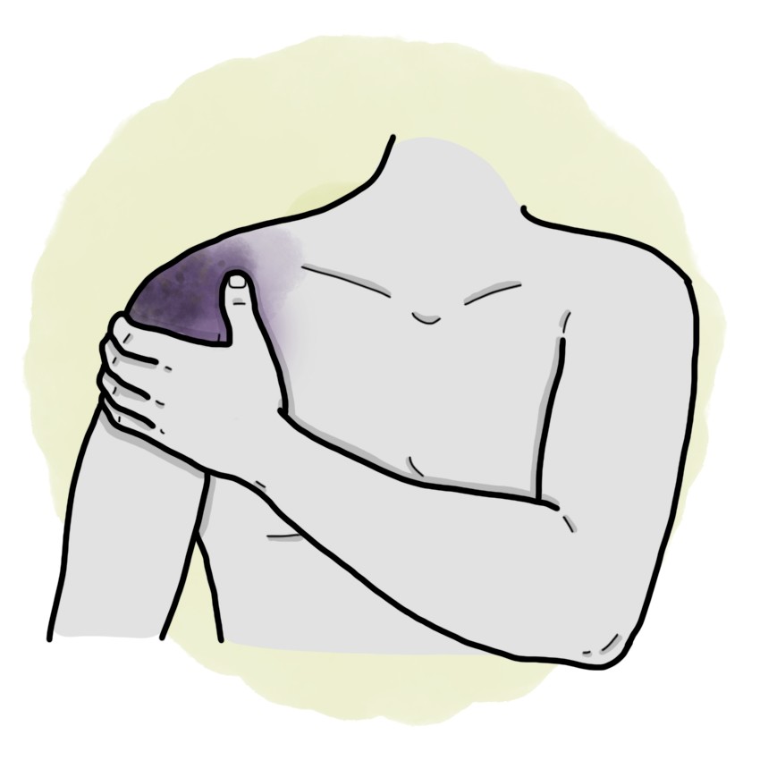 Shoulder trauma