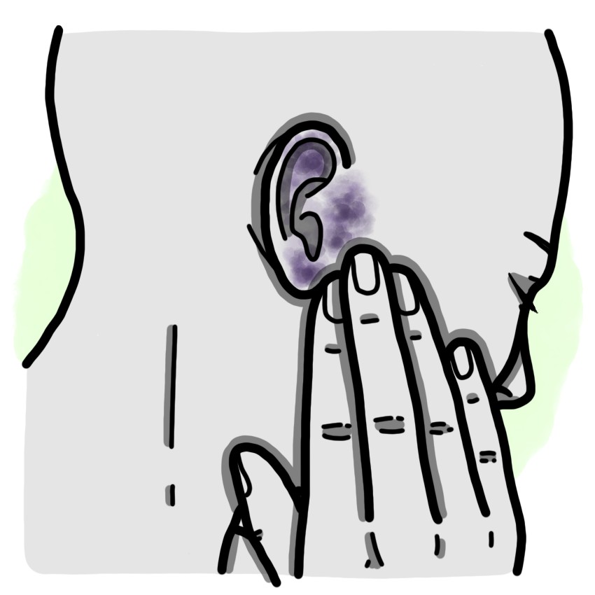 Traumatismo de oreja - Contusión ótica