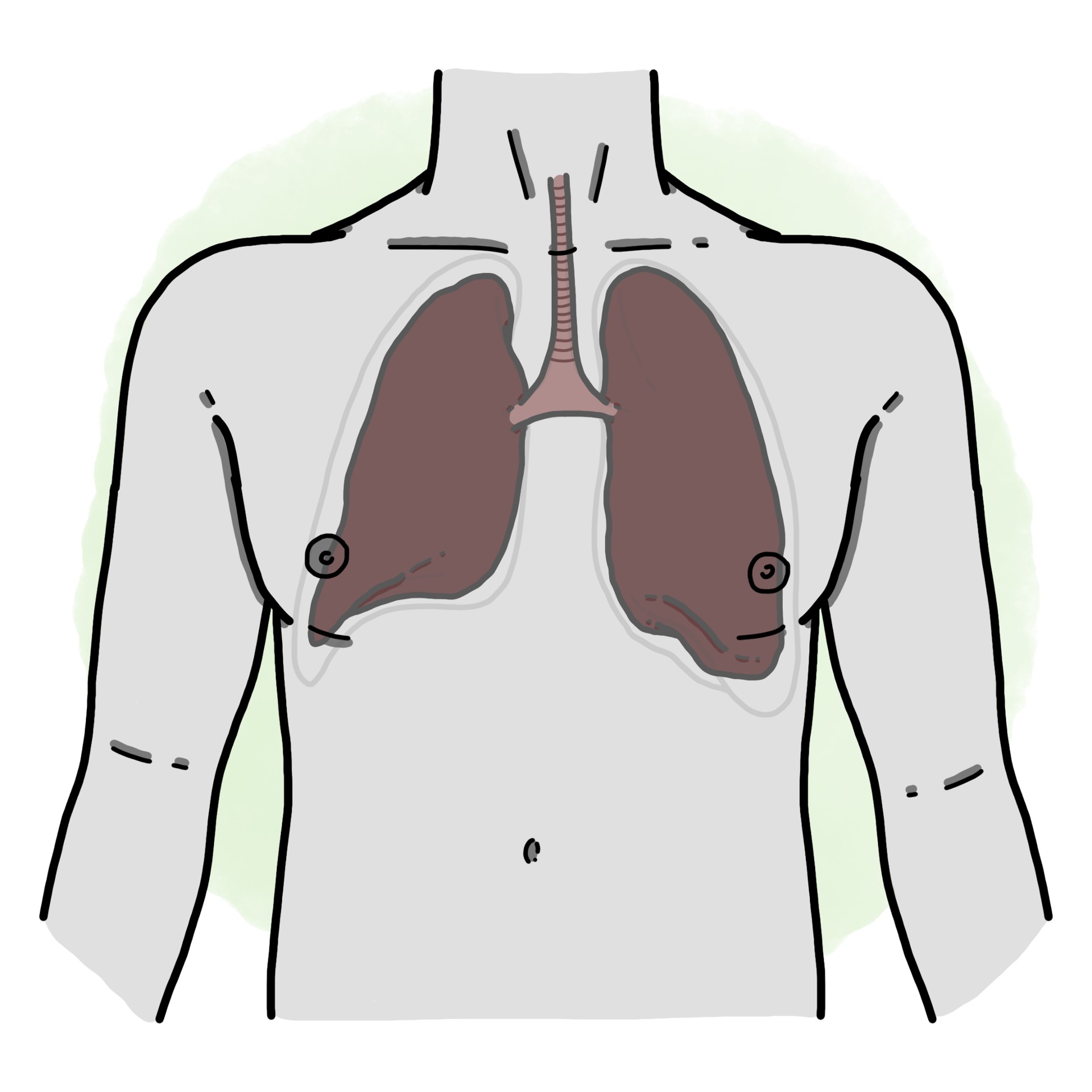 Acute episode of chronic obstructive pulmonary disease - COPD flare-up