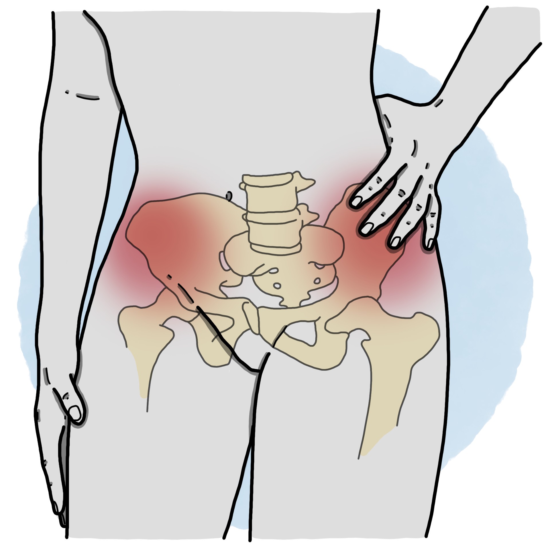 Chronic pelvic pain