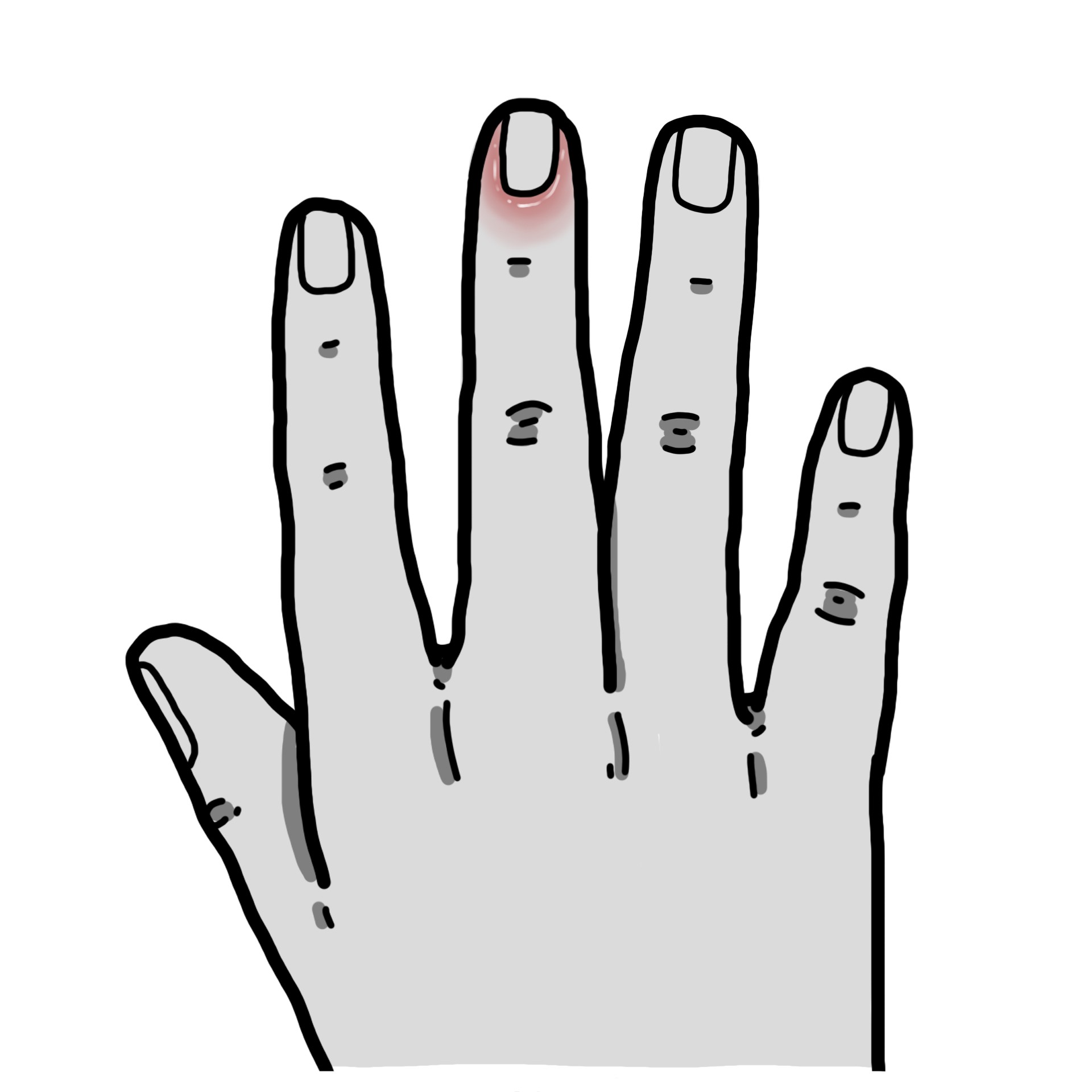 Inflammation around the nail