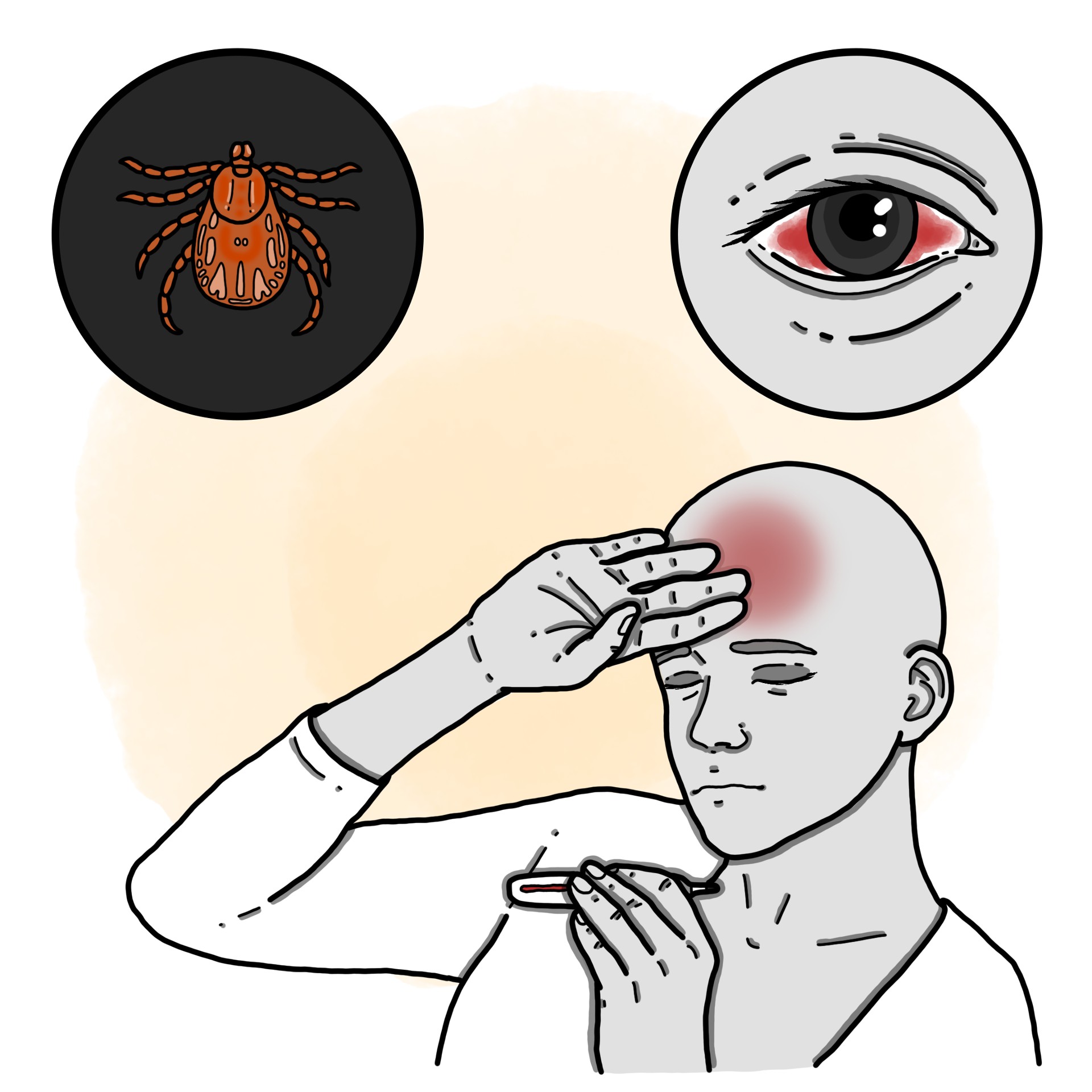 Crimean-Congo haemorrhagic fever