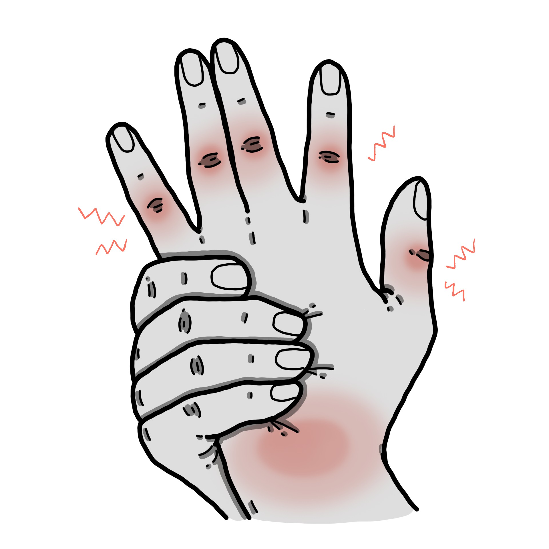 Stijfheid van het gewricht