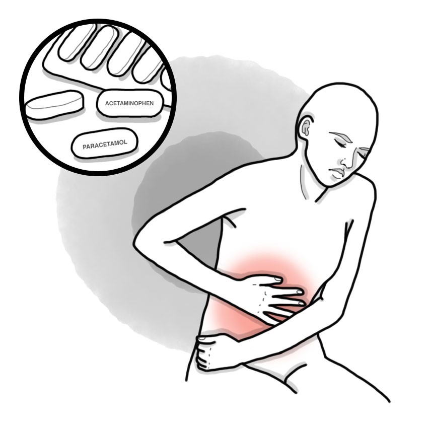 Paracetamol/Acetaminophen poisoning - Acetaminophen