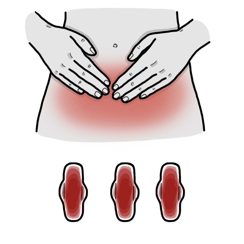 생리의 양이 너무 많거나 생리 기간이 오래 지속됨