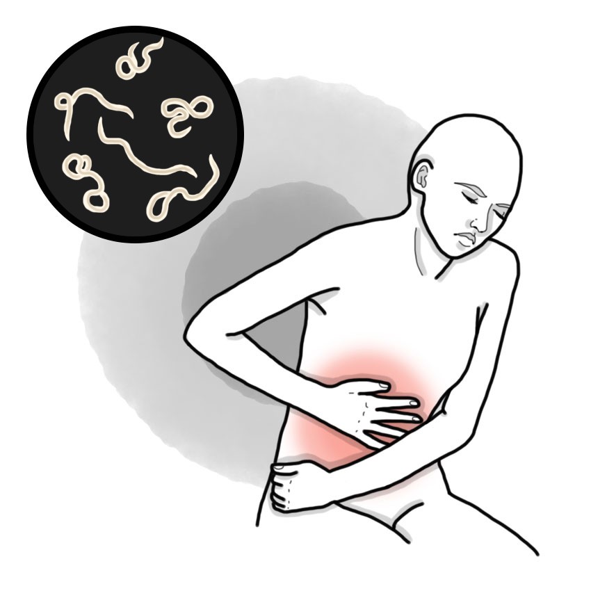 Anisakis poisoning (Paediatrics)