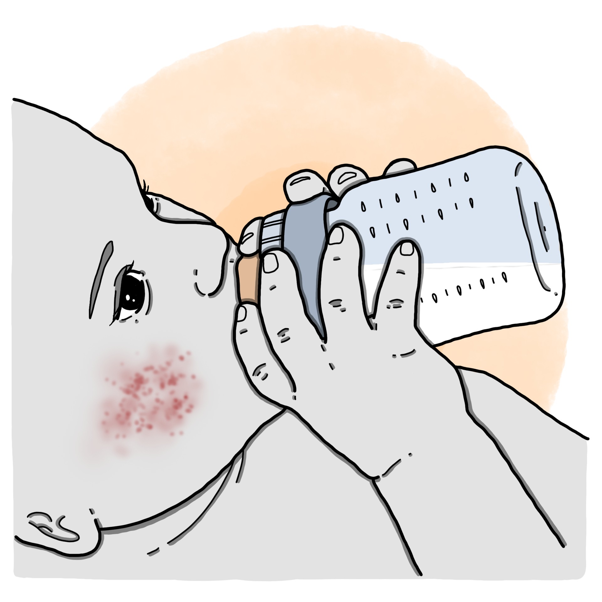 Cow's milk allergy (Paediatrics)