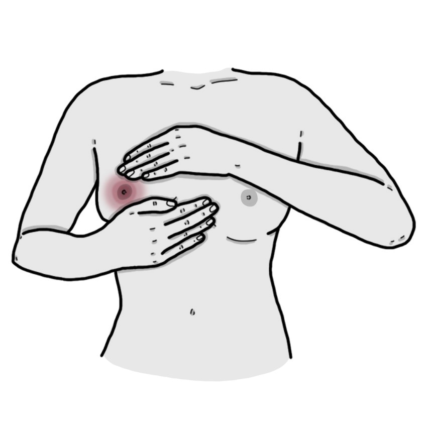 Brustwarzen Schmerzen