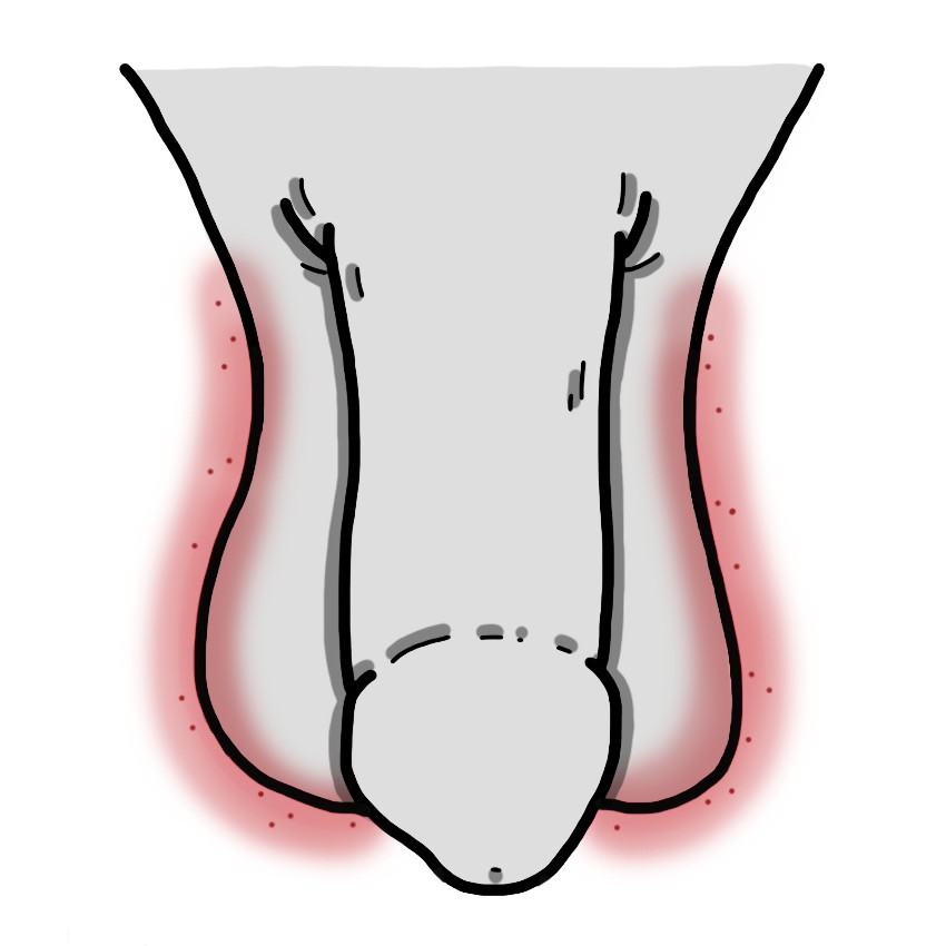 Tingling testicular sensation
