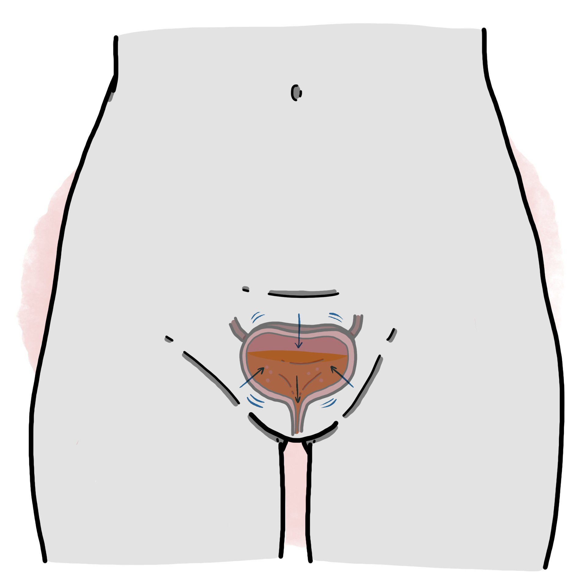 Overactive bladder - Overactive Bladder