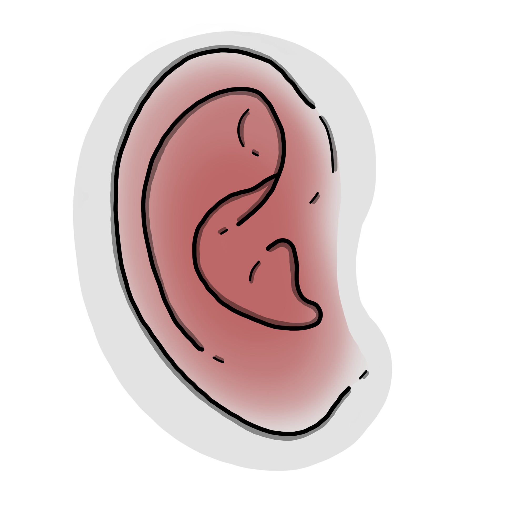 Otalgia