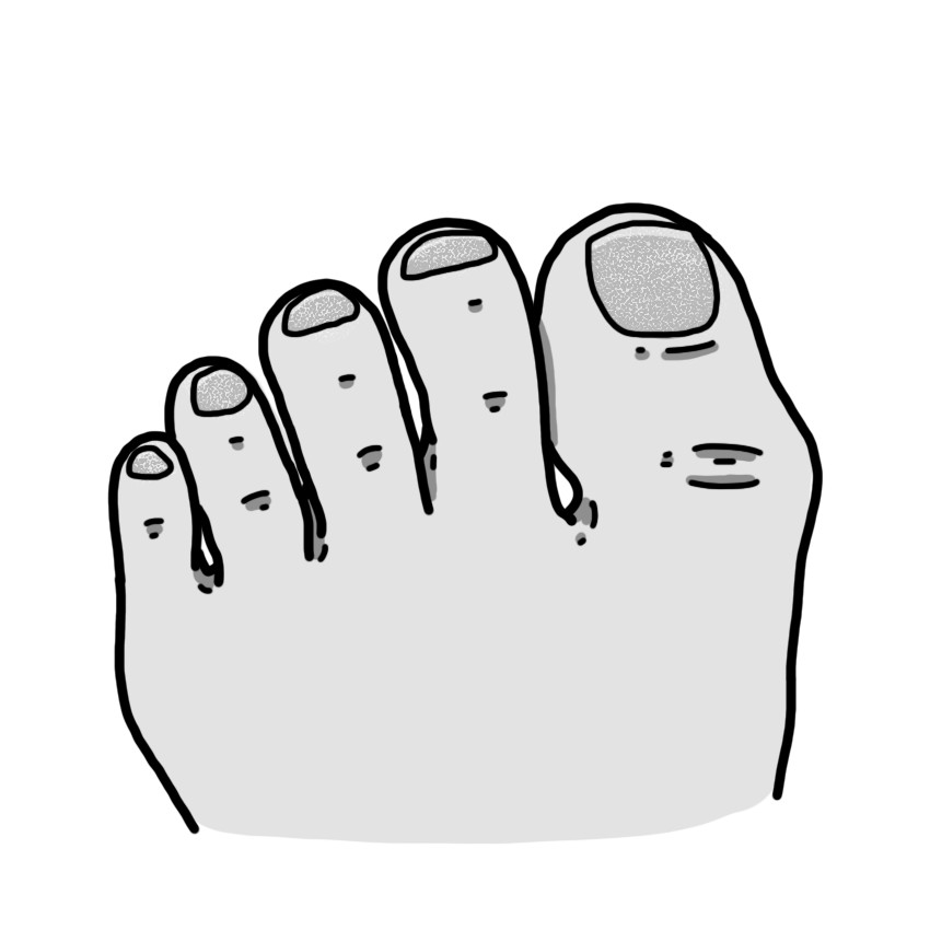 Descamação das unhas