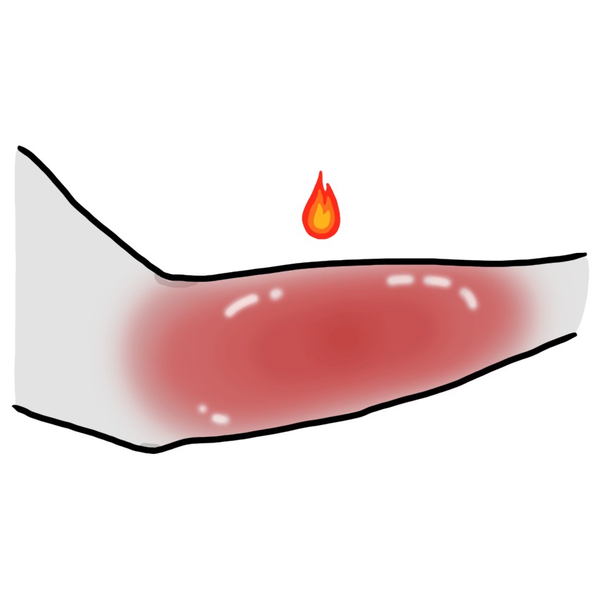 Pelle infiammata, rossa e calda