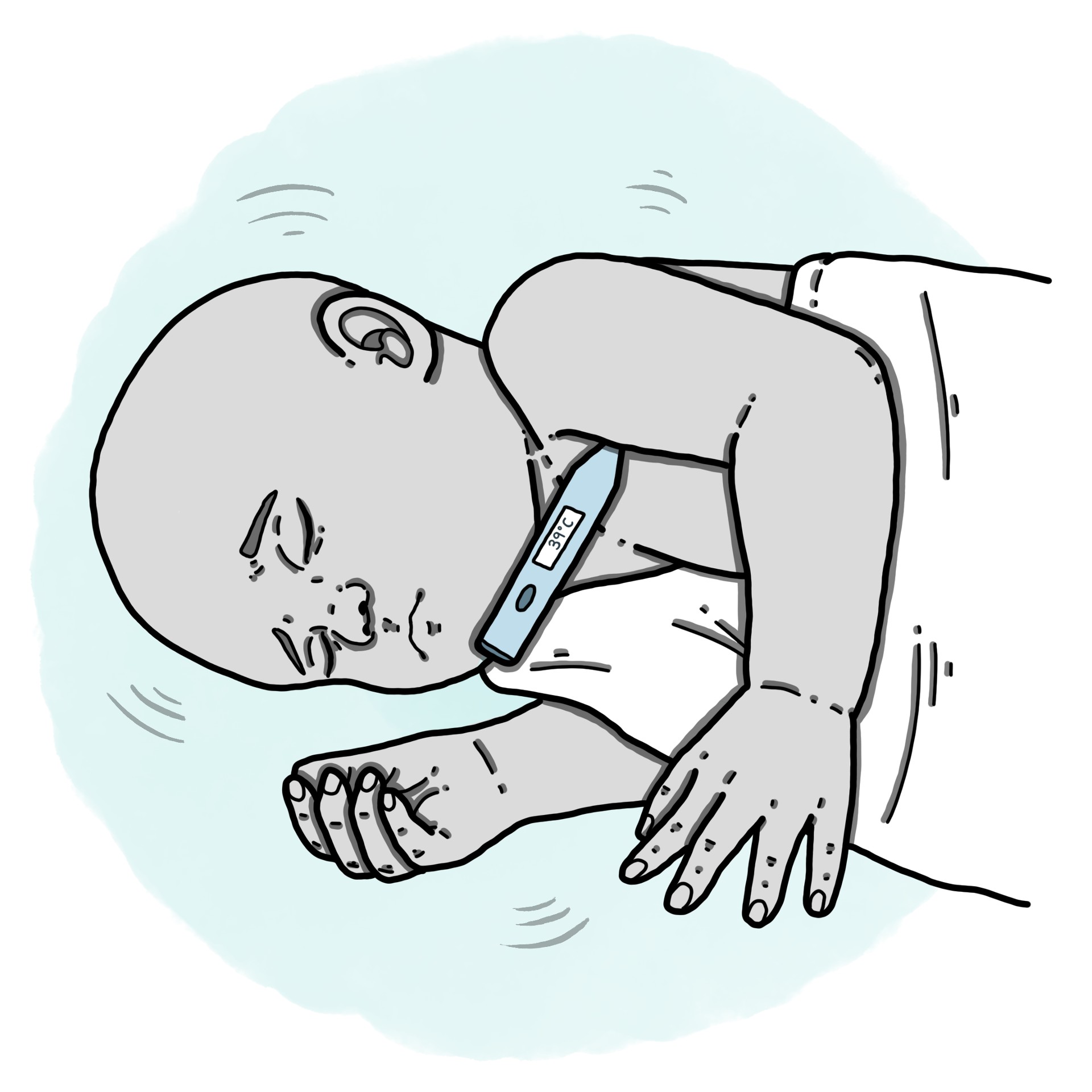 Febrile seizure (Paediatrics)