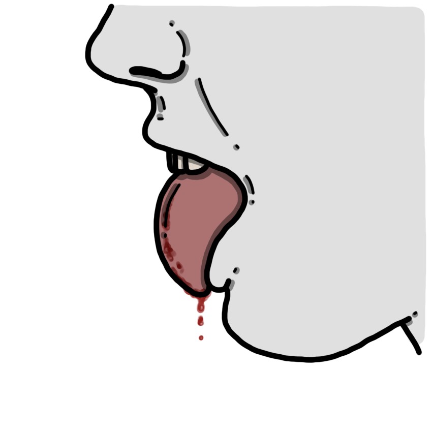 Sangra la lengua