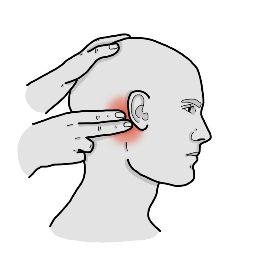 Pain when the region behind the ear is palpated