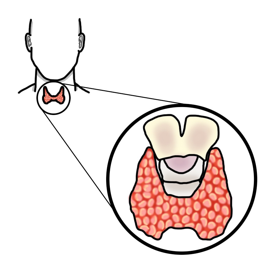 Congenital hypothyroidism (Paediatrics)
