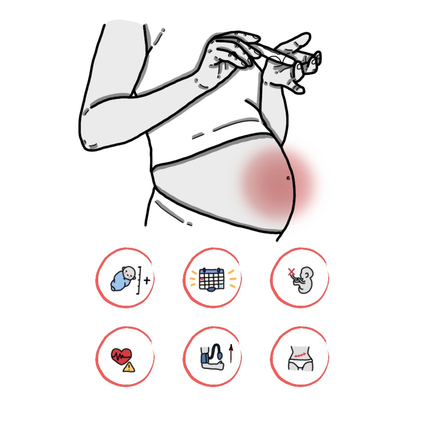 Diabetes complications in pregnancy - Pregestational diabetes