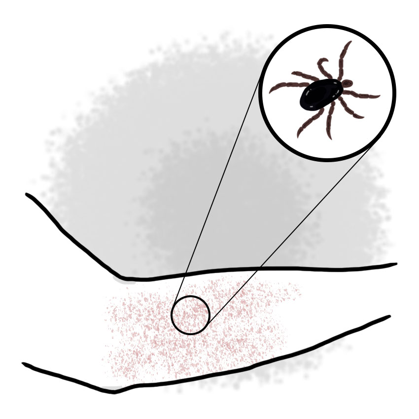 Mediterranean spotted fever (Paediatrics)