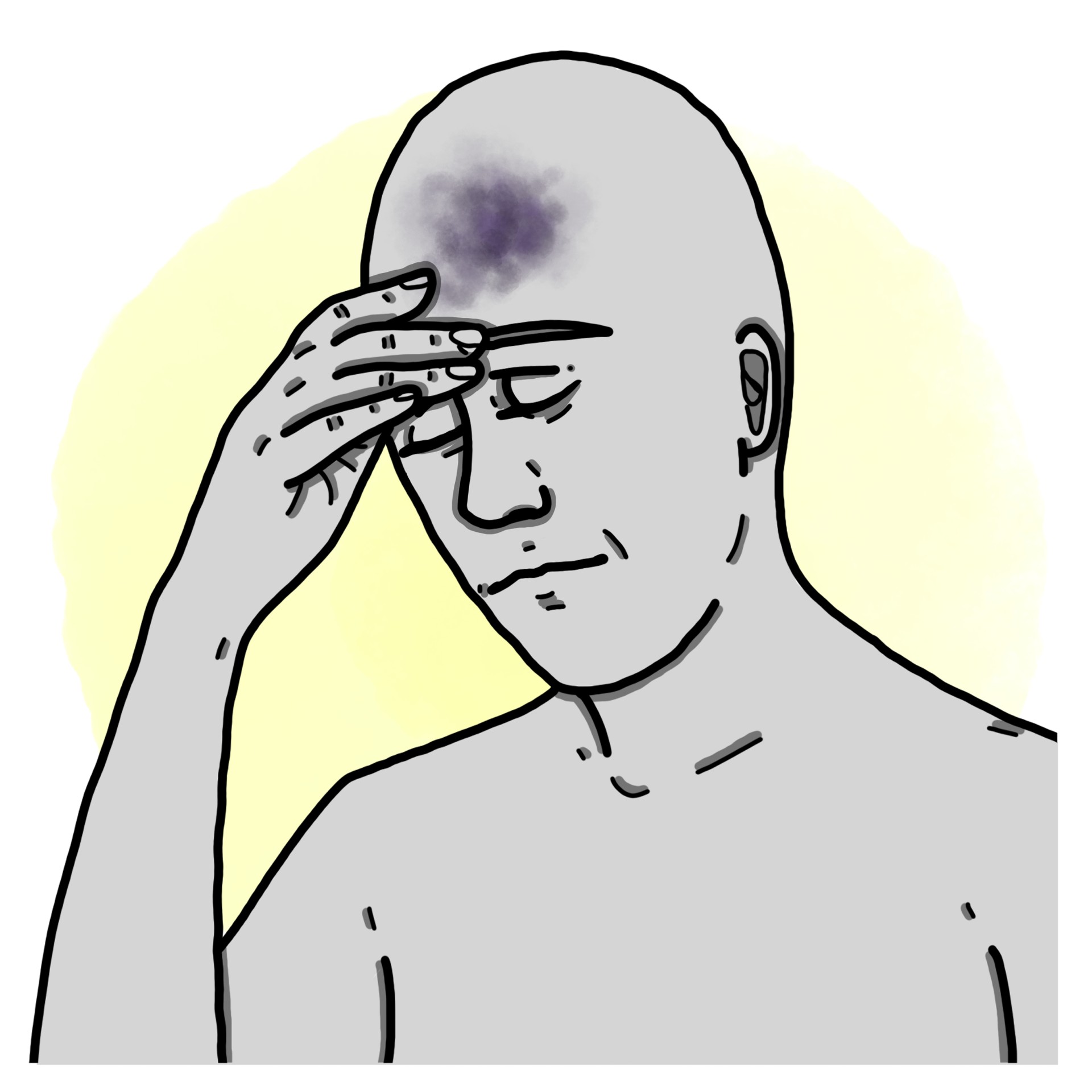 Head concussion - Mild traumatic brain injury