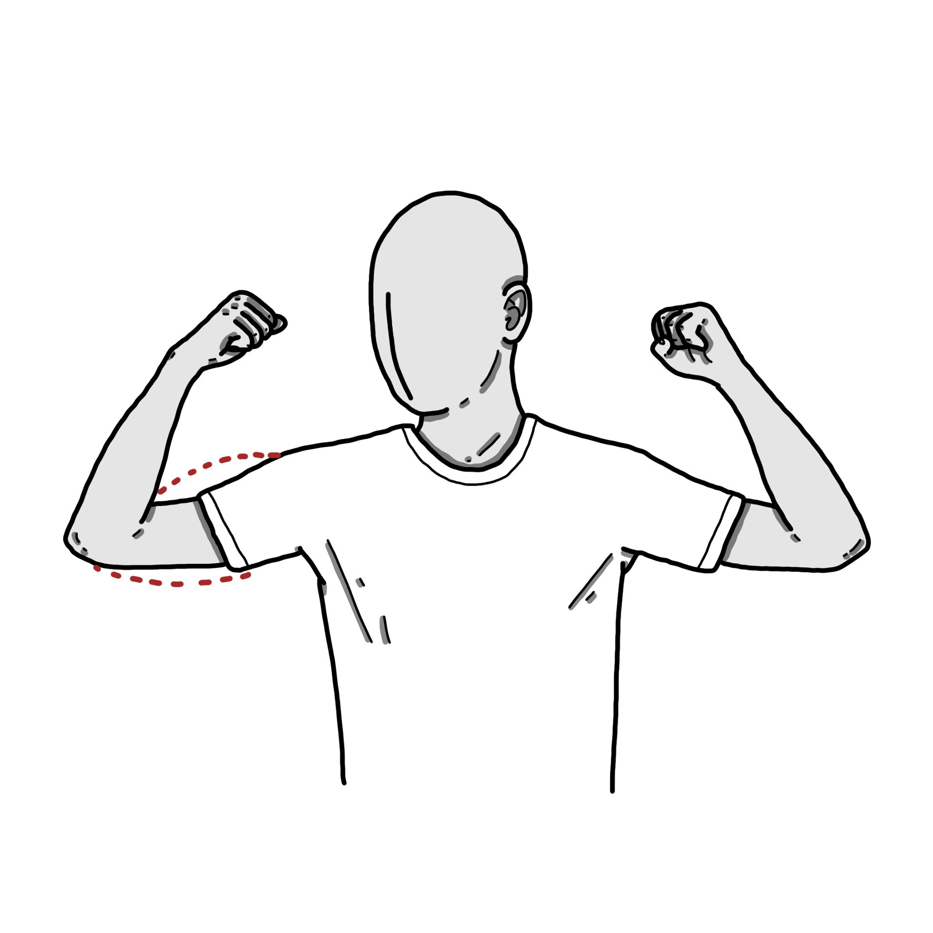 Weakness in biceps of the arm
