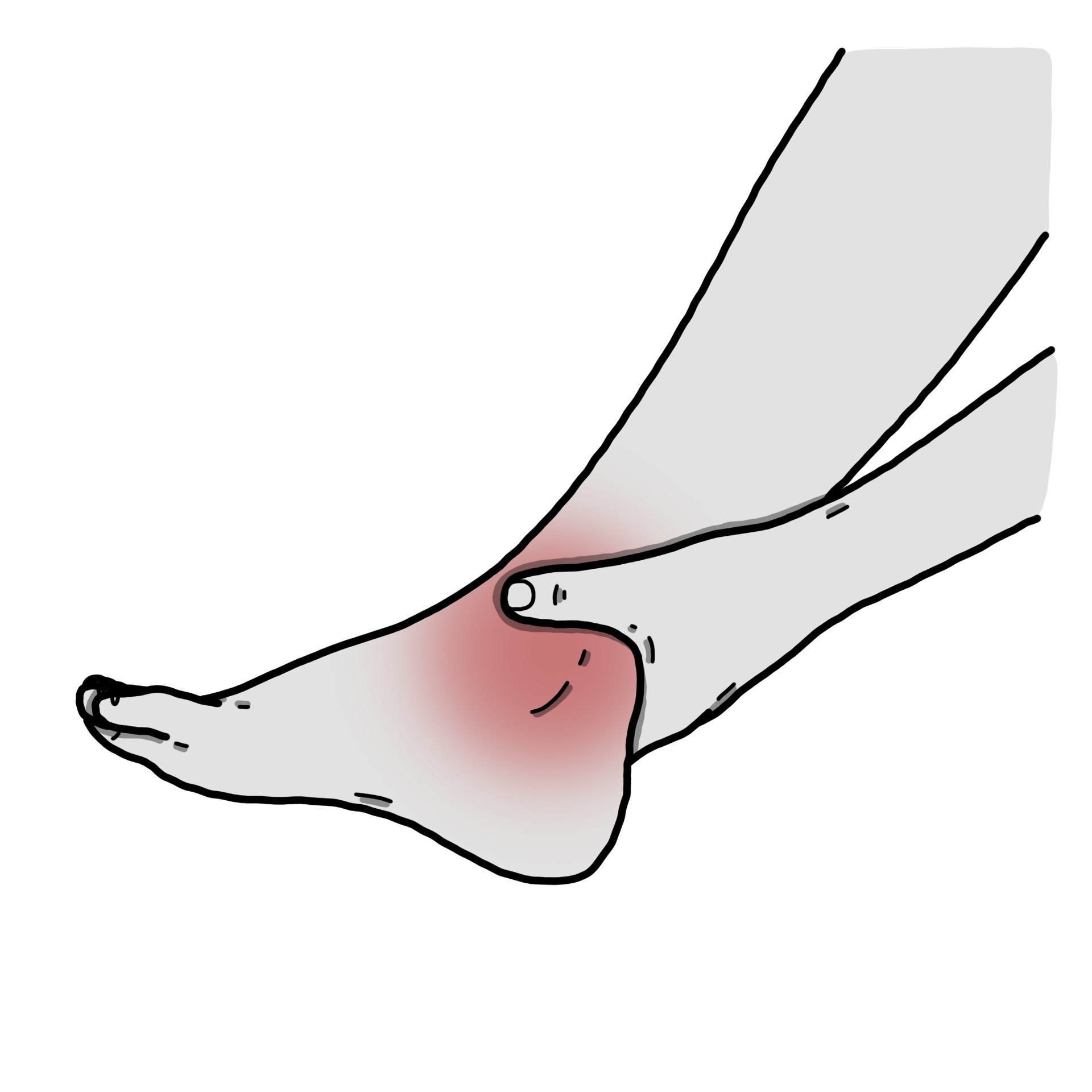 Πόνος στον αστράγαλο