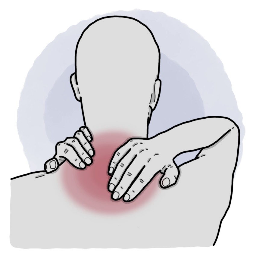 Mechanical cervical pain