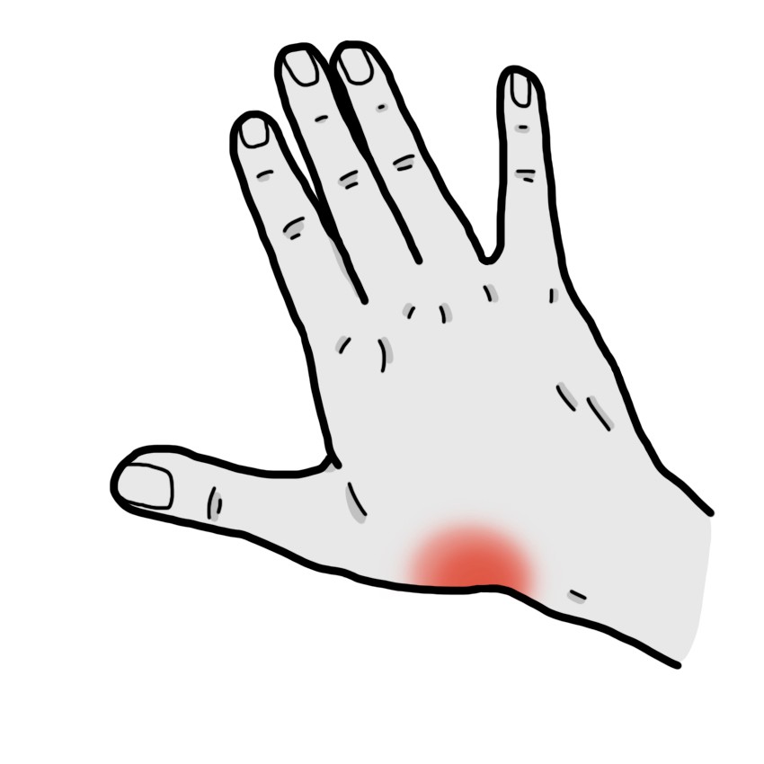Pain in the anatomical snuffbox